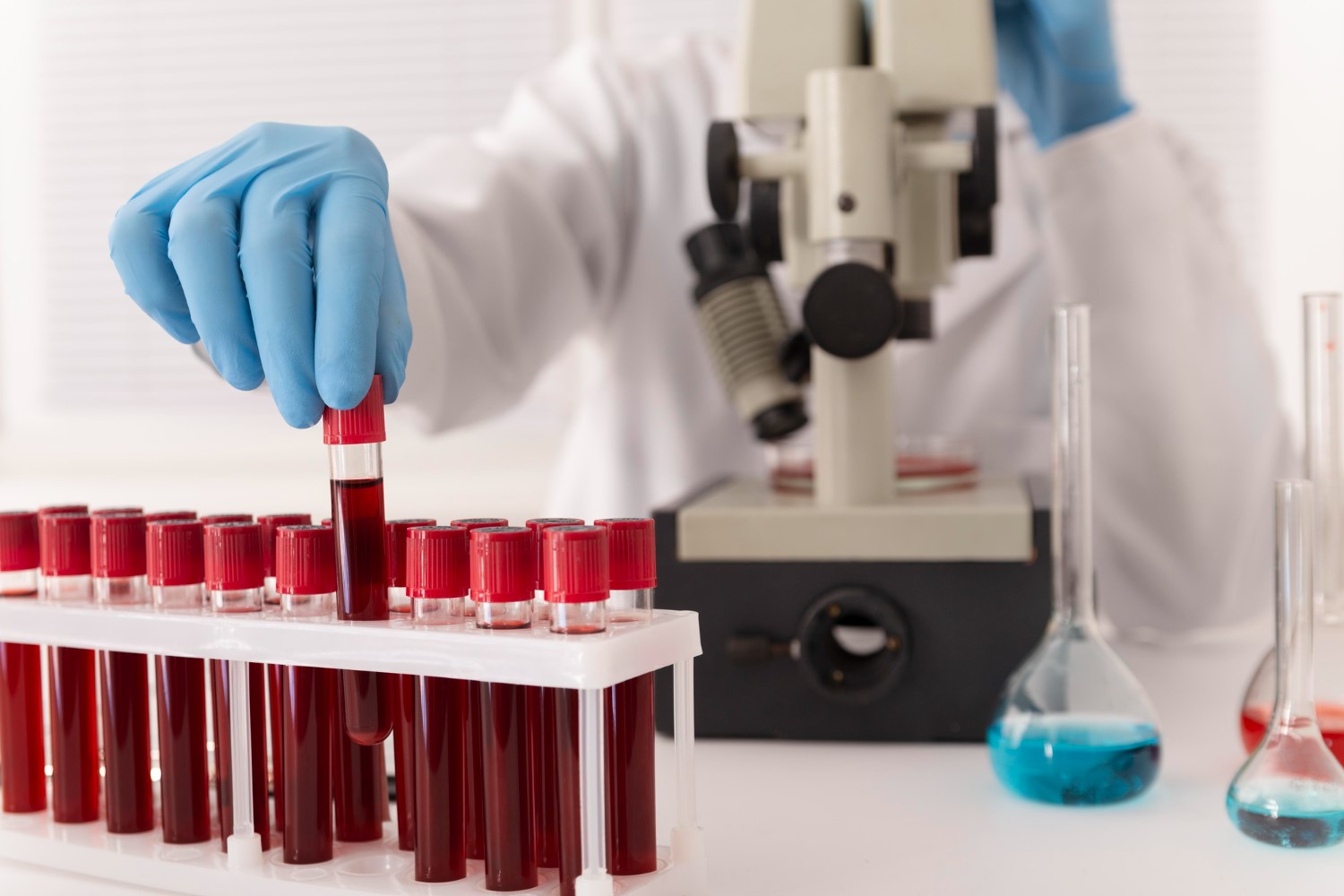 Blood Test